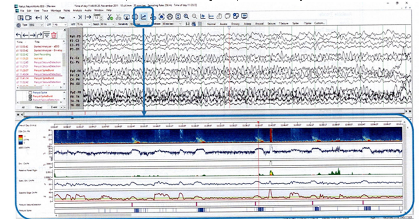 (Website) Natus Xltek 32U (1)