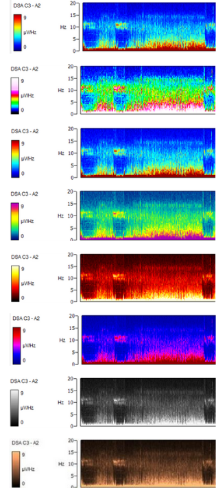 (Website) Natus Embla Dx Series (11).1